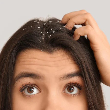Anti Dandruff